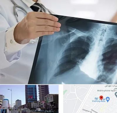 فوق تخصص ریه در چهارراه طالقانی کرج