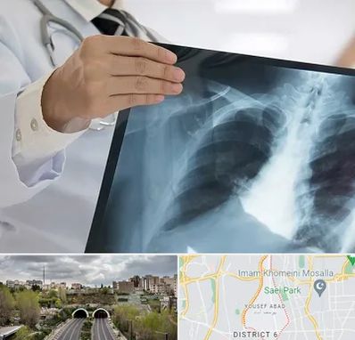 فوق تخصص ریه در یوسف آباد 