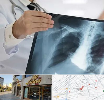 فوق تخصص ریه در عطاران قم