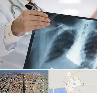 فوق تخصص ریه در بندر ماهشهر