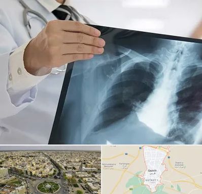 فوق تخصص ریه در قزوین