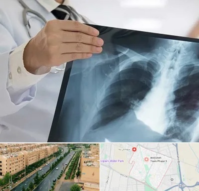 فوق تخصص ریه در فاز سه اندیشه