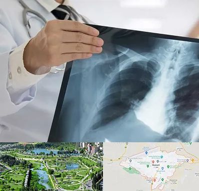 فوق تخصص ریه در بجنورد