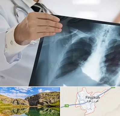 فوق تخصص ریه در فیروزکوه