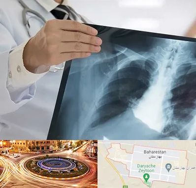 فوق تخصص ریه در بهارستان