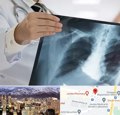 فوق تخصص ریه در جردن 