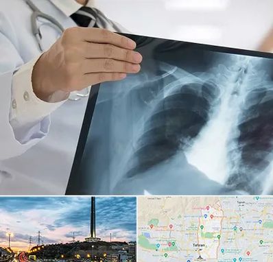 فوق تخصص ریه در منطقه 2 تهران 