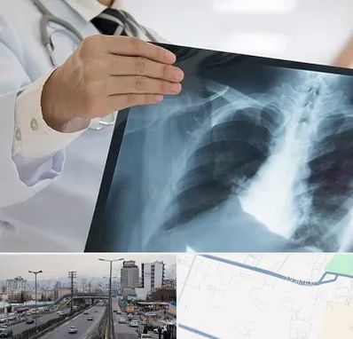 فوق تخصص ریه در بلوار ارتش