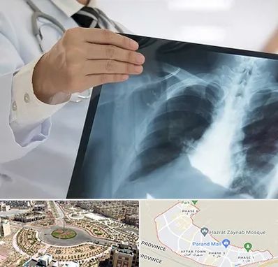 فوق تخصص ریه در پرند