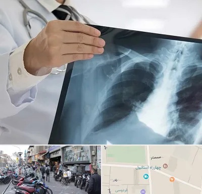 فوق تخصص ریه در چهارراه استانبول