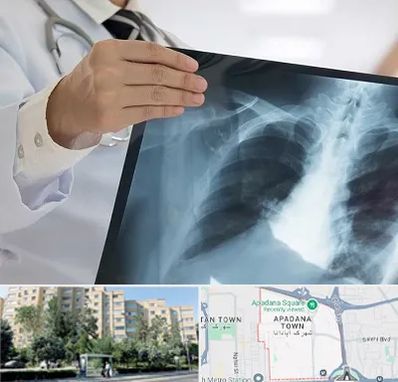 فوق تخصص ریه در آپادانا