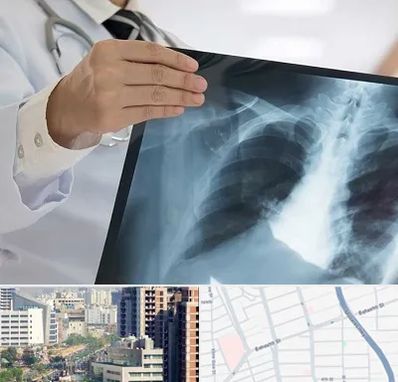 فوق تخصص ریه در خیابان بهشتی