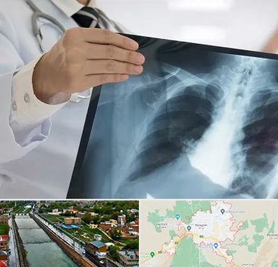 فوق تخصص ریه در مراغه