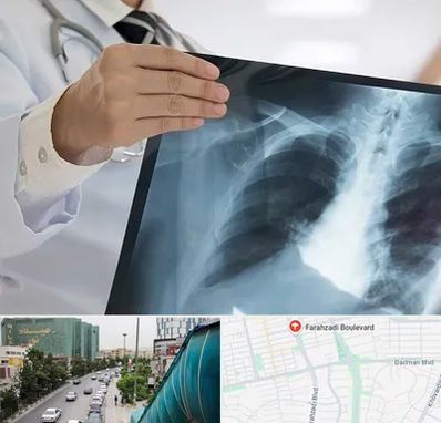 فوق تخصص ریه در بلوار فرحزادی