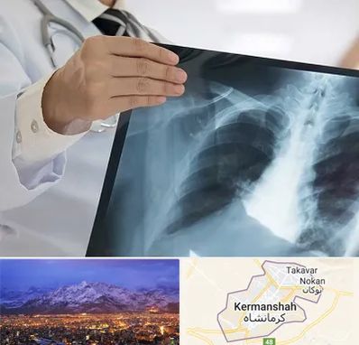 فوق تخصص ریه در کرمانشاه