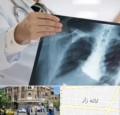 فوق تخصص ریه در لاله زار