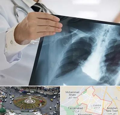 فوق تخصص ریه در فردیس کرج 
