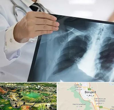 فوق تخصص ریه در بروجرد