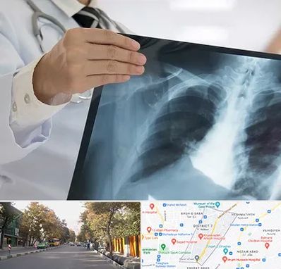 فوق تخصص ریه در شریعتی 