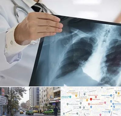 فوق تخصص ریه در فاطمی 