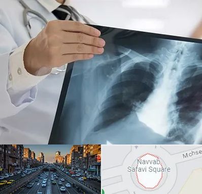 فوق تخصص ریه در نواب