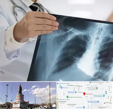 فوق تخصص ریه در کارگر جنوبی 