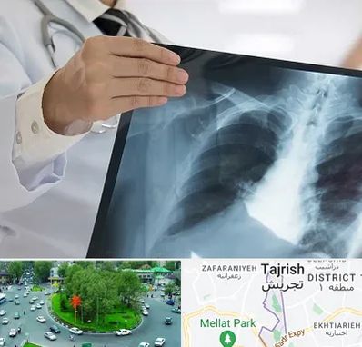 فوق تخصص ریه در تجریش 