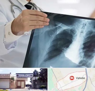 فوق تخصص ریه در وحیدیه شهریار