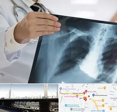 فوق تخصص ریه در پارک وی 