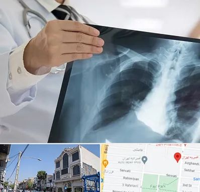 فوق تخصص ریه در افسریه 