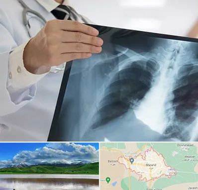 فوق تخصص ریه در مرند