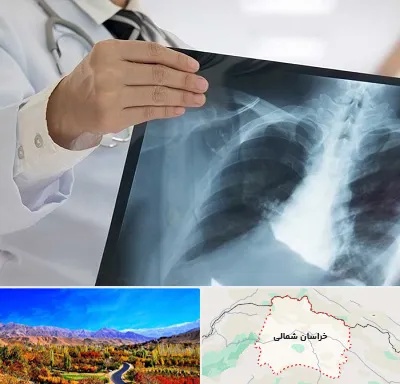 فوق تخصص ریه در خراسان شمالی