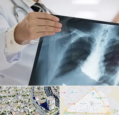 فوق تخصص ریه در قاسم آباد مشهد