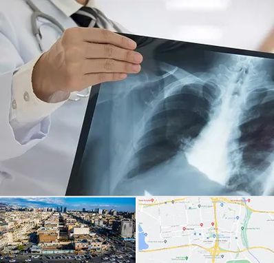 فوق تخصص ریه در شهرک راه آهن