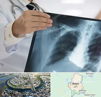 فوق تخصص ریه در بابل