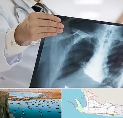 فوق تخصص ریه در چابهار