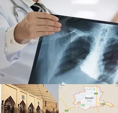 فوق تخصص ریه در ساوه