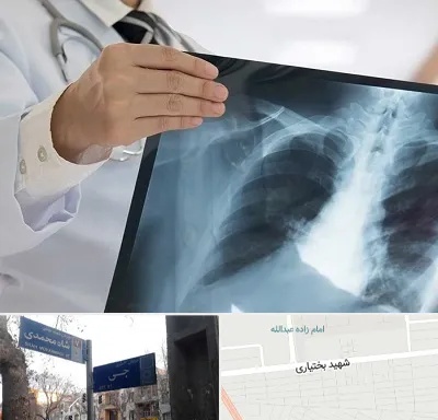 فوق تخصص ریه در سی متری جی