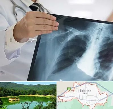 فوق تخصص ریه در بهشهر
