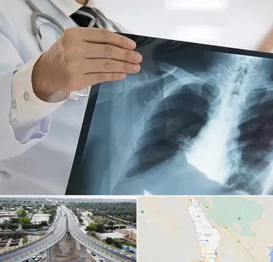 فوق تخصص ریه در اندیمشک