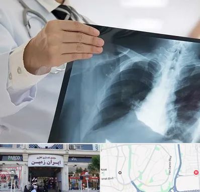 فوق تخصص ریه در ایران زمین