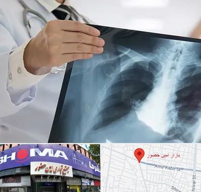 فوق تخصص ریه در امین حضور