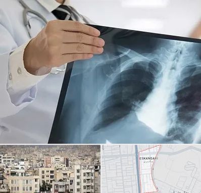 فوق تخصص ریه در اسکندری