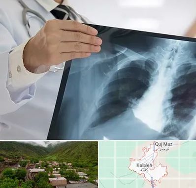 فوق تخصص ریه در کلاله