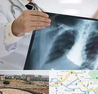 فوق تخصص ریه در کوی وحدت شیراز