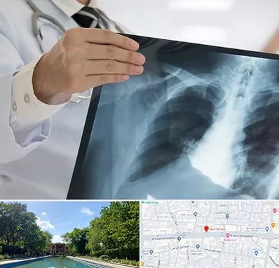 فوق تخصص ریه در هشت بهشت اصفهان