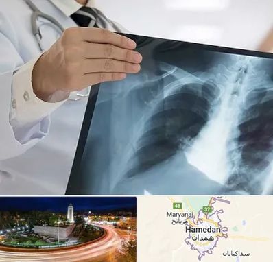 فوق تخصص ریه در همدان