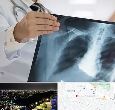 فوق تخصص ریه در هفت تیر مشهد