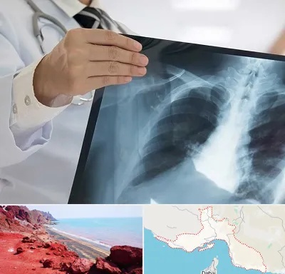 فوق تخصص ریه در هرمزگان
