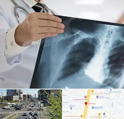 فوق تخصص ریه در ستاری 